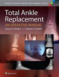 Total Ankle Replacement:  An Operative Manual