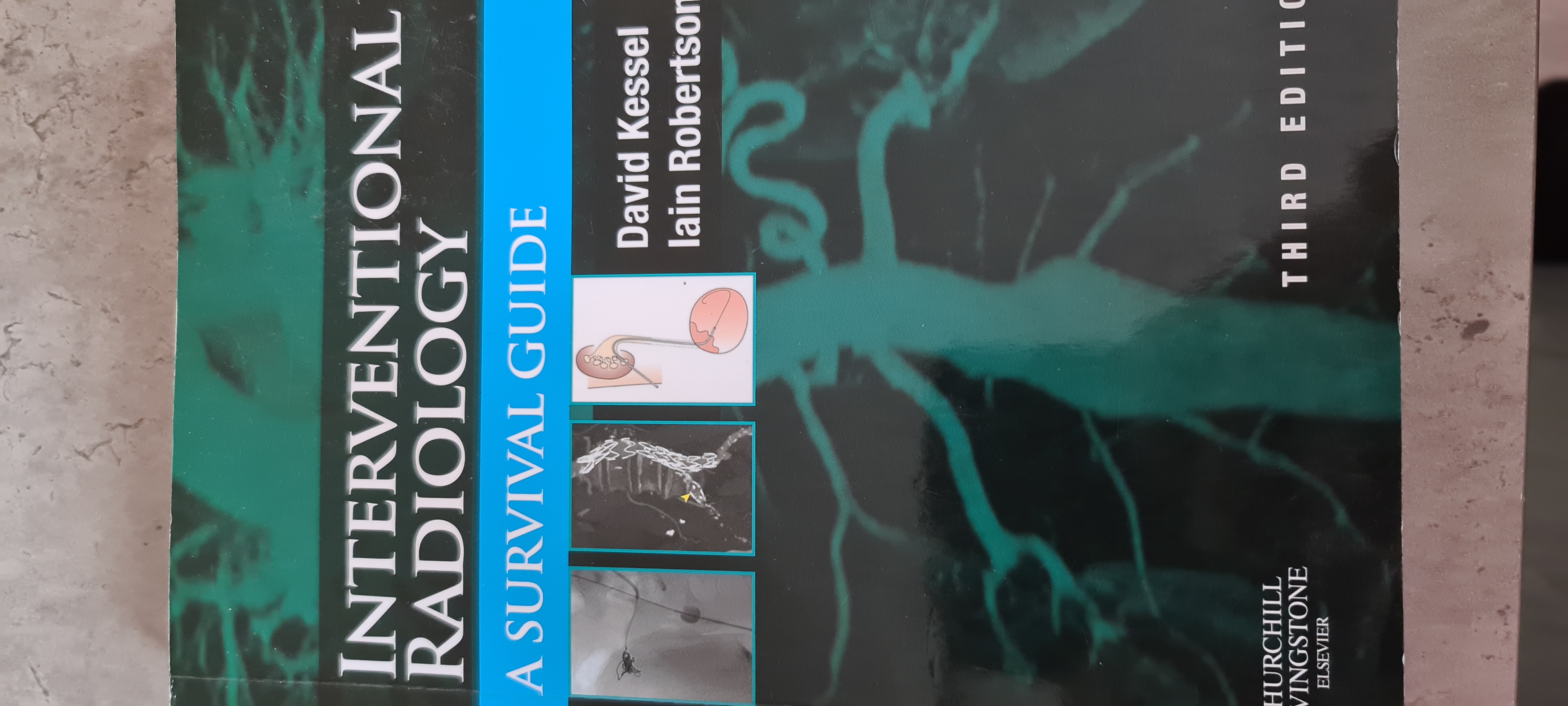 Interventional Radiology