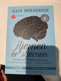 Hjernen er stjernen