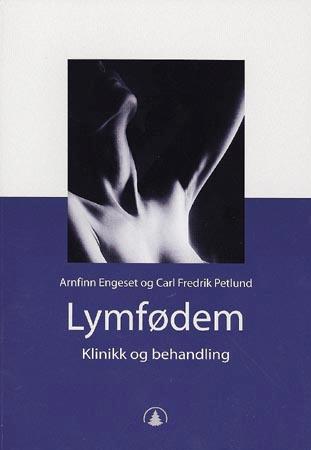 Lymfødem