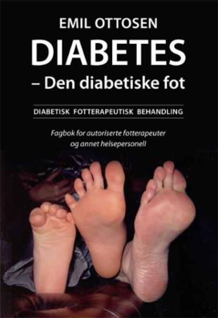 Diabetes - den diabetiske fot