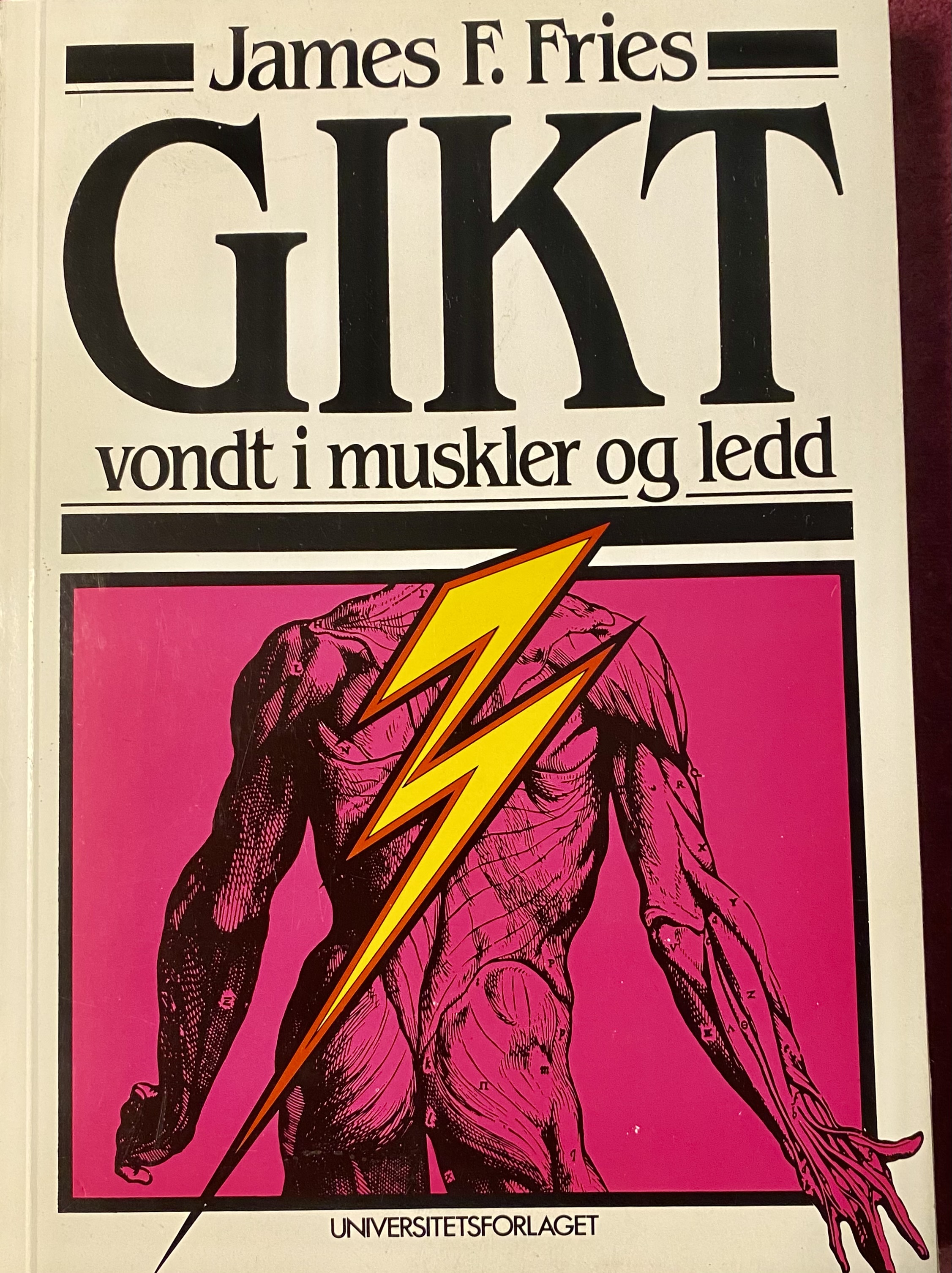 Gikt