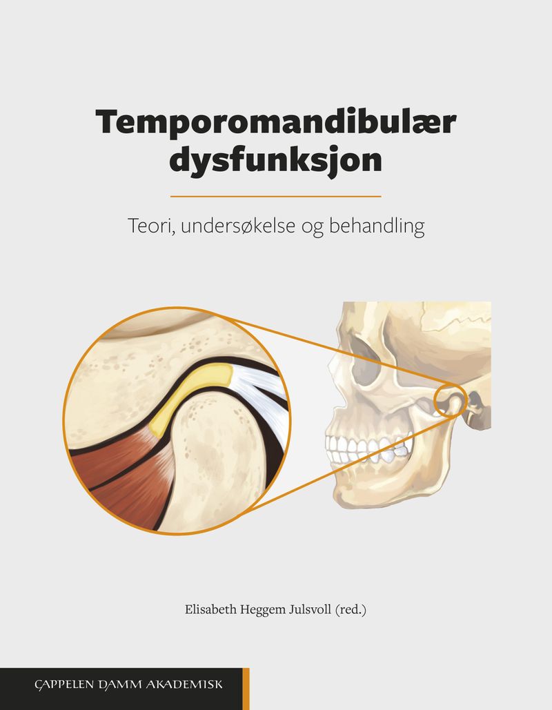 Temporomandibulær dysfunksjon
