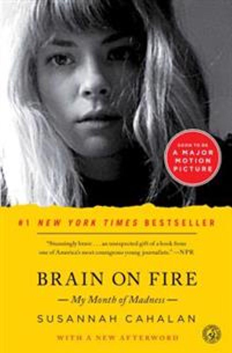 Brain on fire
